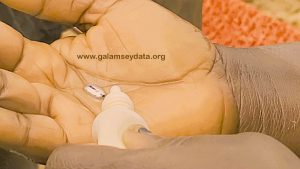 A woman pouring mercury in her hand without protection